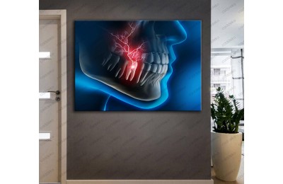 Ağız ve Diş Polikliniği, Dişçi Tabloları Dekoratif Diş, Dekoratif Dişçi, Dişçi Dekorasyonu dsc195